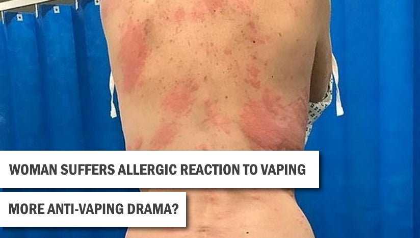 Mother 'suffers an allergic reaction to VAPING'