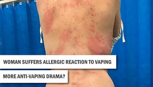 Mother 'suffers an allergic reaction to VAPING'